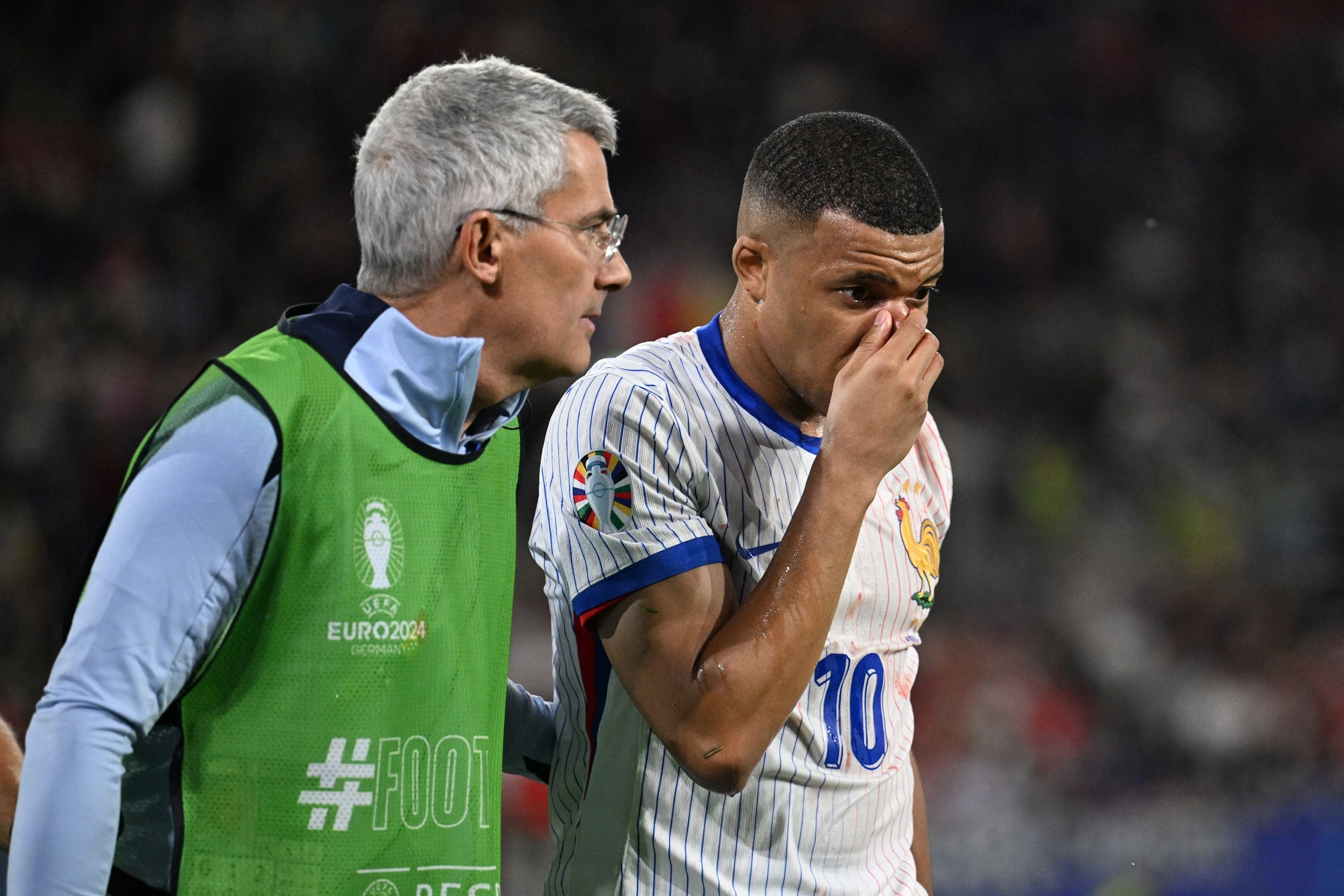 Mbappe dính chấn thương nặng gãy mũi, HLV Deschamps lo thắt ruột